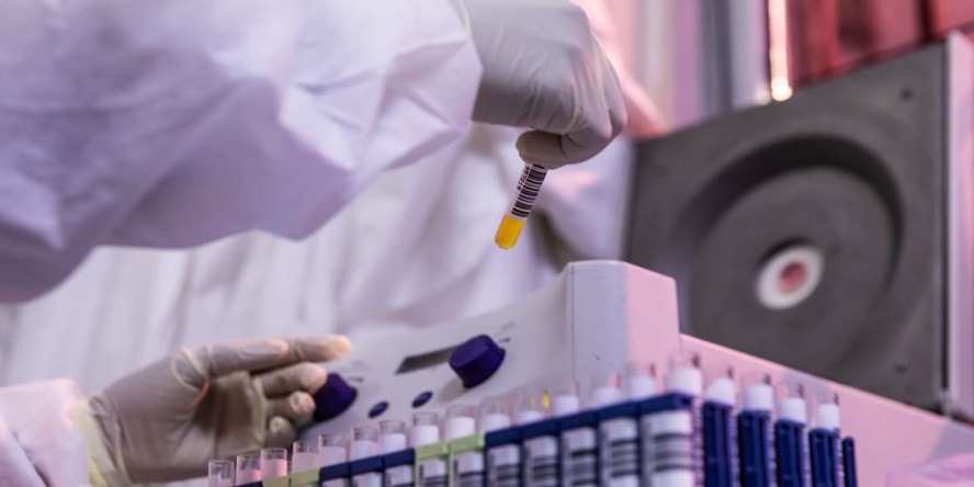 A lab worker examines specimens in test tubes.